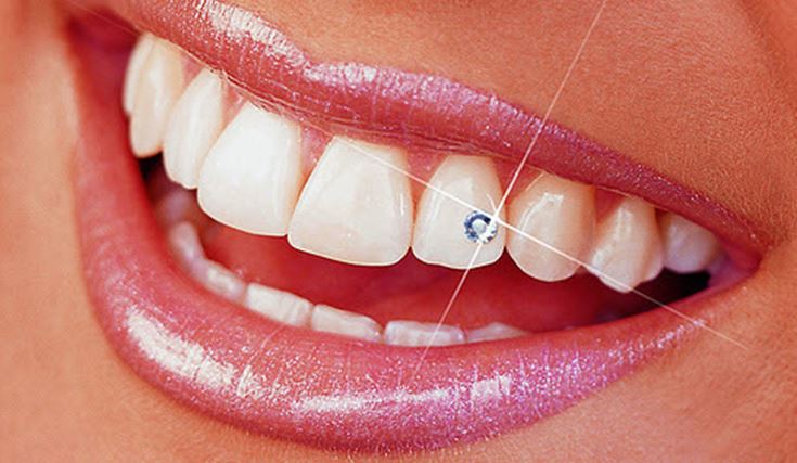Blog 14 Brillantino al dente