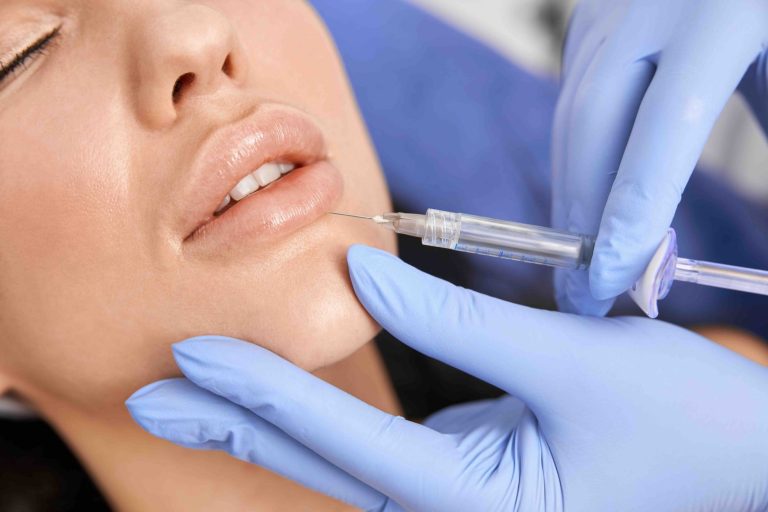 Blog 11 Filler labbra a Firenze