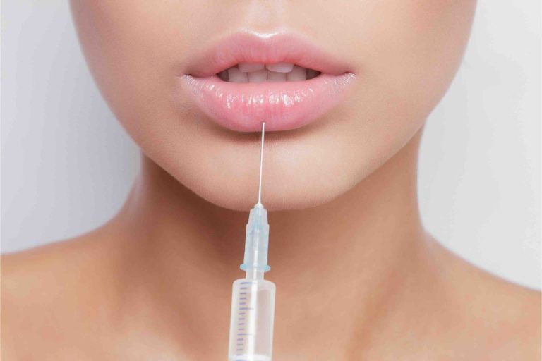 Blog 10 Filler labbra a Prato