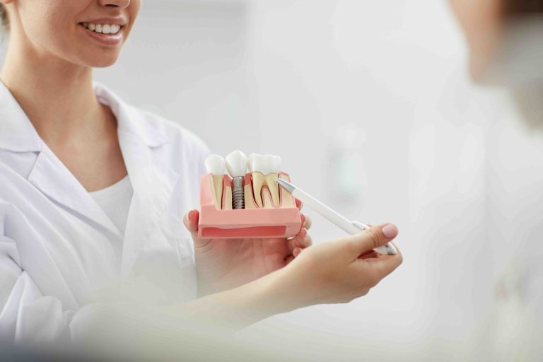Blog 8 Implantologia dentale pro e contro a Prato