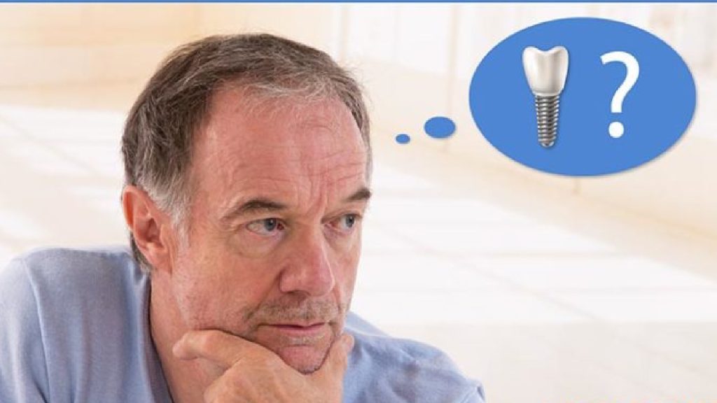 QUANTO COSTA UN IMPIANTO DENTALE